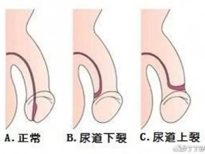 fistingvideos 头交尿眼正常吗？为什么会这样？如何避免？